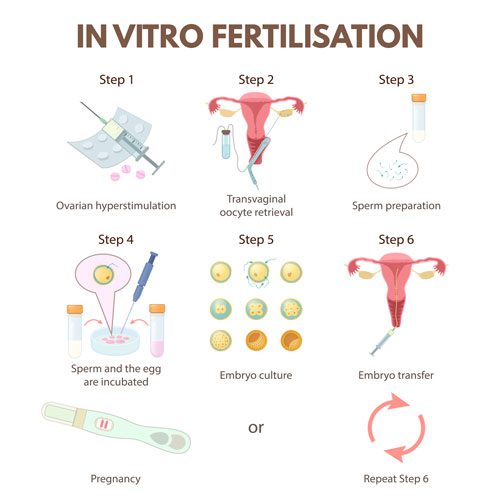 In-Vitro Fertilisation